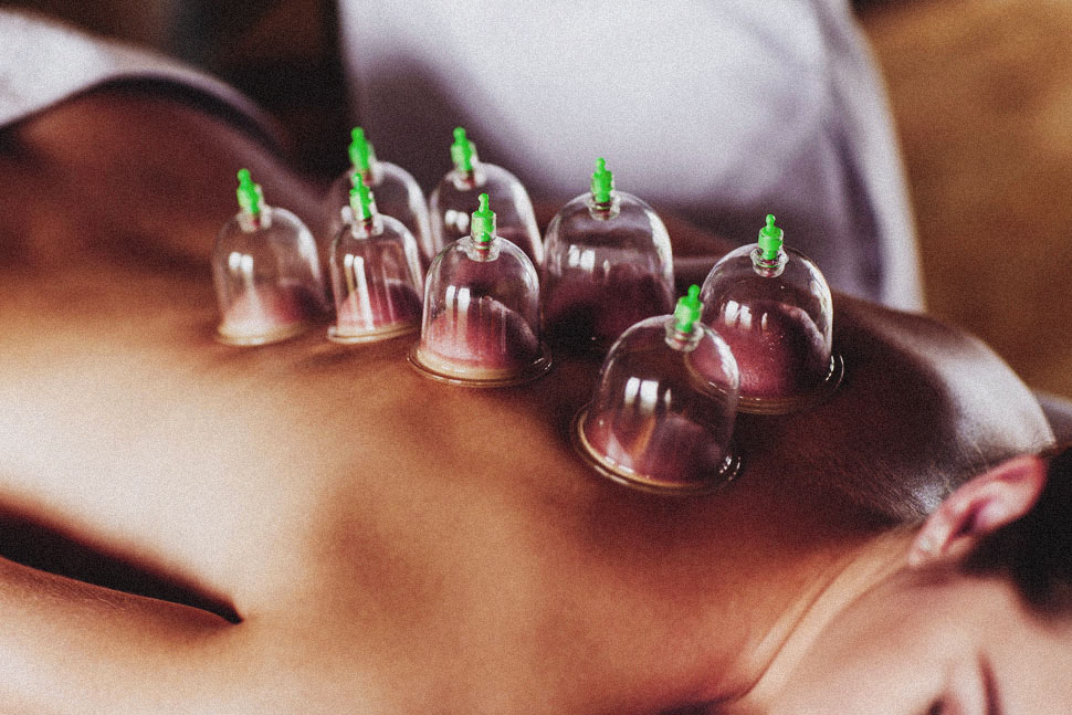 massage cupping